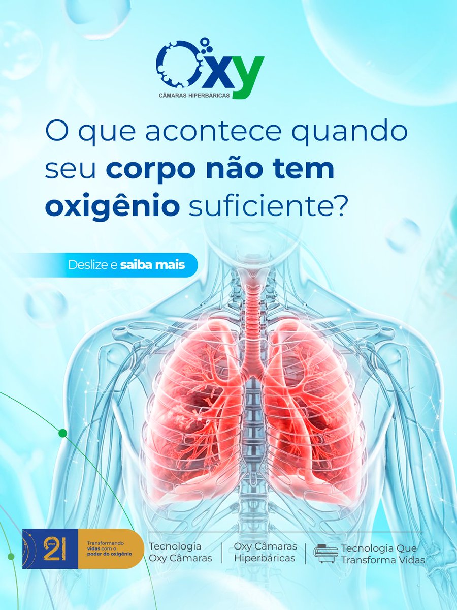 Oxy Câmaras tweet media