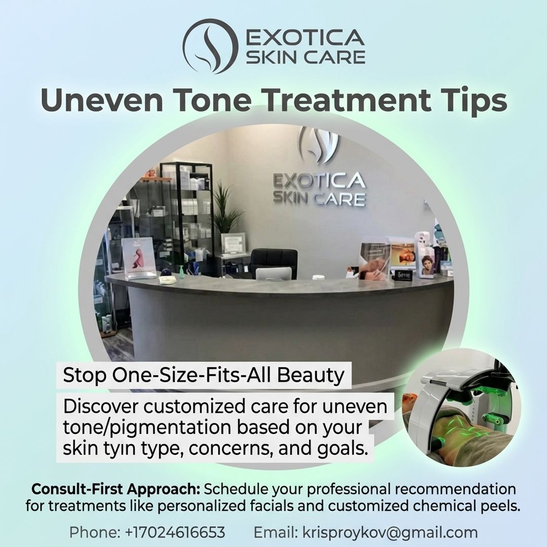 kproykov's tweet image. Covering dark marks is easy, but improving the look of uneven tone starts with the right treatment plan—call +17024616653 or email krisproykov@gmail.com. #ExoticaSkinCare #pigmentation #facials #vipeel #hydrafacial #acnetreatments #scarlet