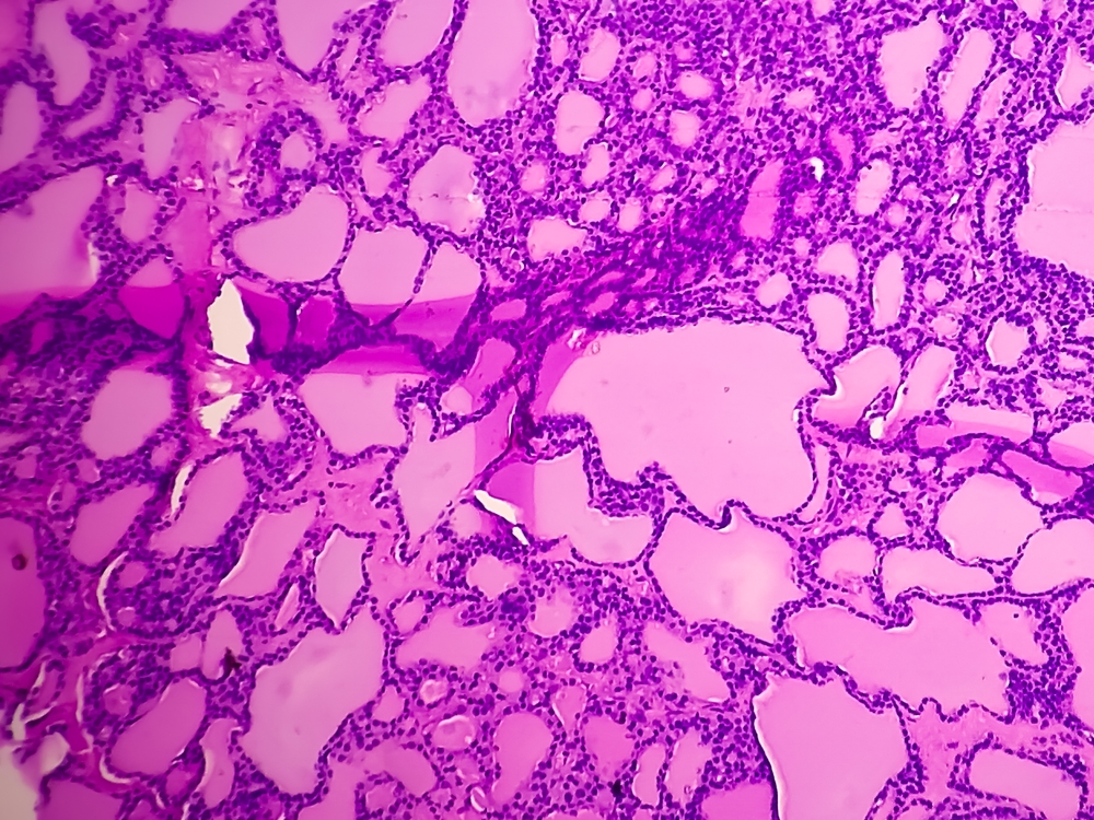RC of Pathologists tweet media