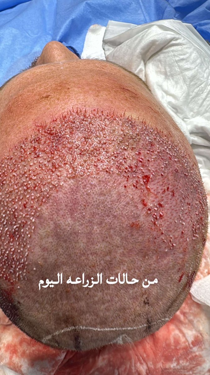 د. خالد العبدالوهاب (@dr_alabdulwahab) on Twitter photo 