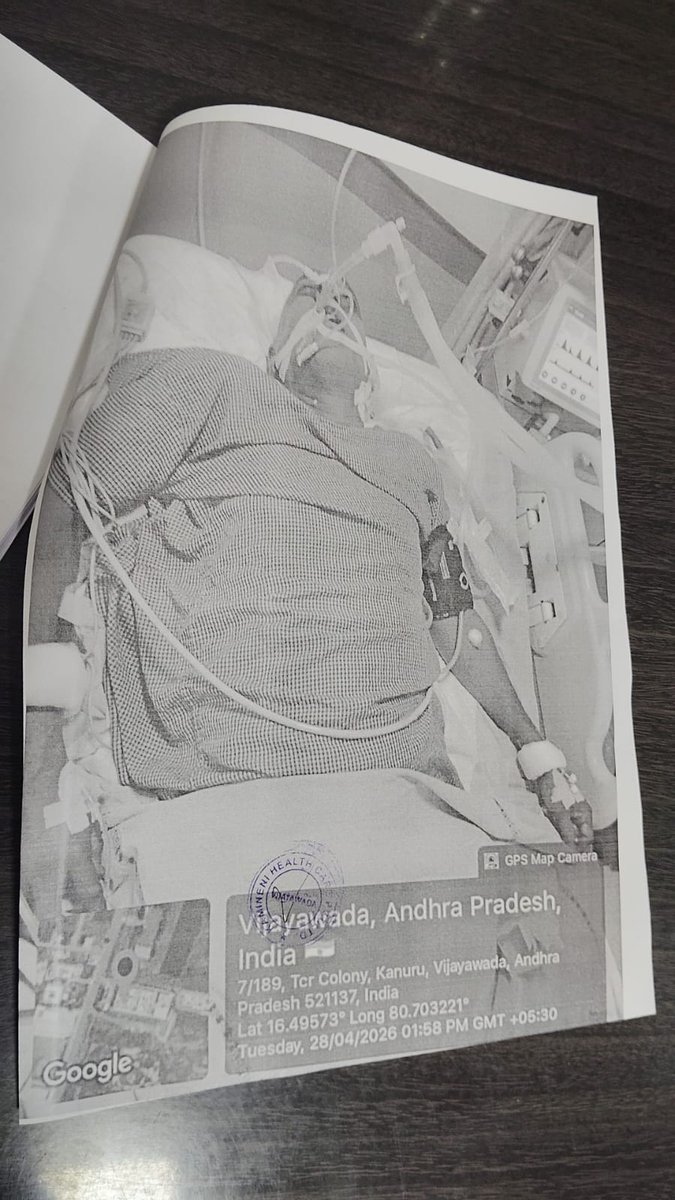 itsmeguysMK's tweet photo. Hello sir @naralokesh @ncbn @JaiTDP he is my friends father and yesterday two wheeler hit him and ran away and now he is in hospital bed and condition is too critical. Blood clot in brain and doctors are saying surgery will cost around 6lks https://t.co/b3jfE3JgKj