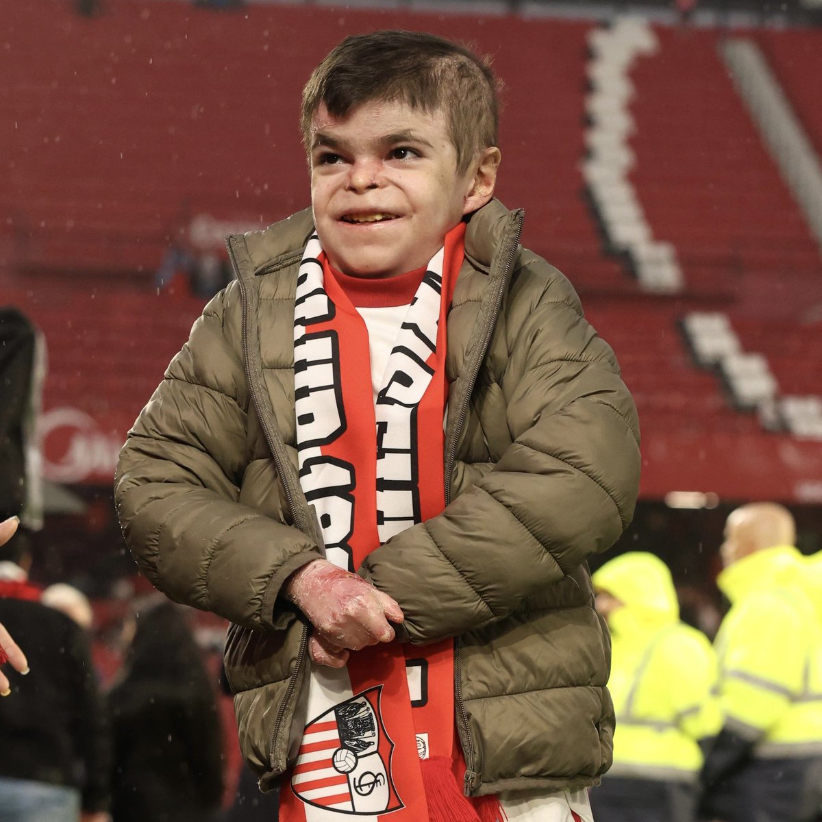 Leo, después de 12 años de lucha, se ha administrado Vyjuvek 😍😍😍

Desde este lunes, Andalucía ha empezado a suministrar el medicamento para los pacientes con Piel de Mariposa. 

👏🏼 ¡Nos alegramos muchísimo y estamos muy orgullosos de ti, Leo! ❤️