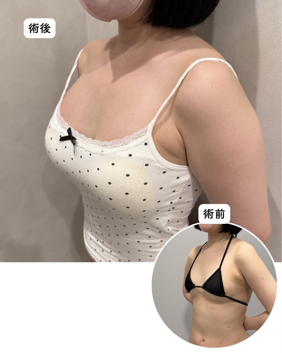 富田さくら🌸女医の豊胸/脂肪吸引【さくらバストクリニック 新宿】 tweet media