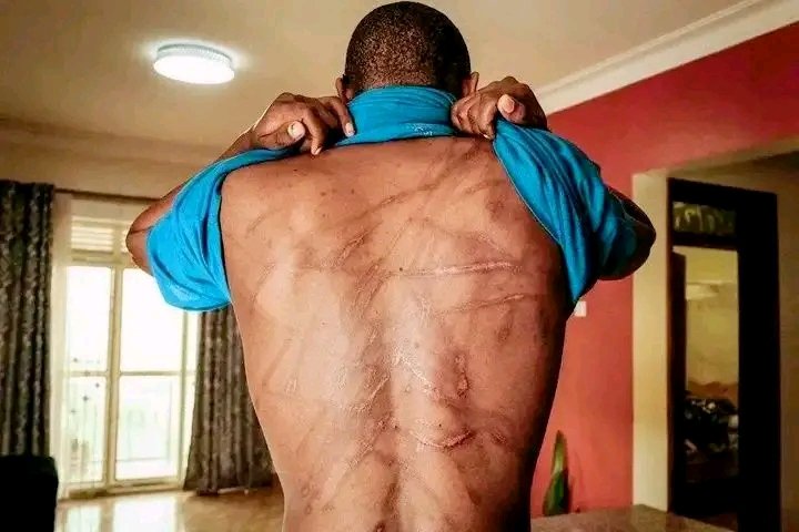 Je demande humblement à Son Excellence la Première Dame, <a href="/DeniseNyakeru/">Denise NYAKERU TSHISEKEDI</a>, d’agir avec la même énergie et la même promptitude dans l’affaire REBO, qui a fait tabasser  son chauffeur, comme elle l’a fait pour la dame qui avait été “sauvée” par les gifles d’un médecin.