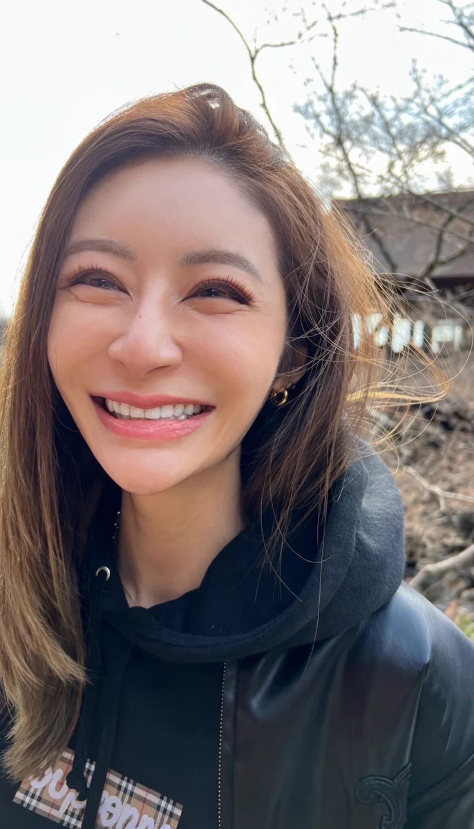 宮崎 麗香 整形