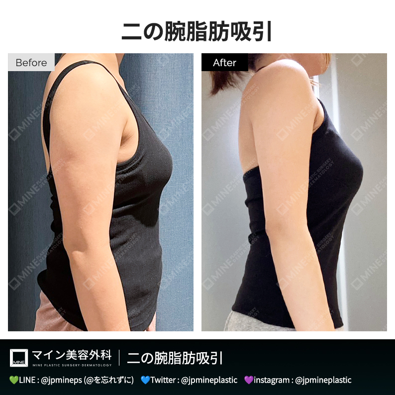 マイン美容外科・皮膚科 tweet media