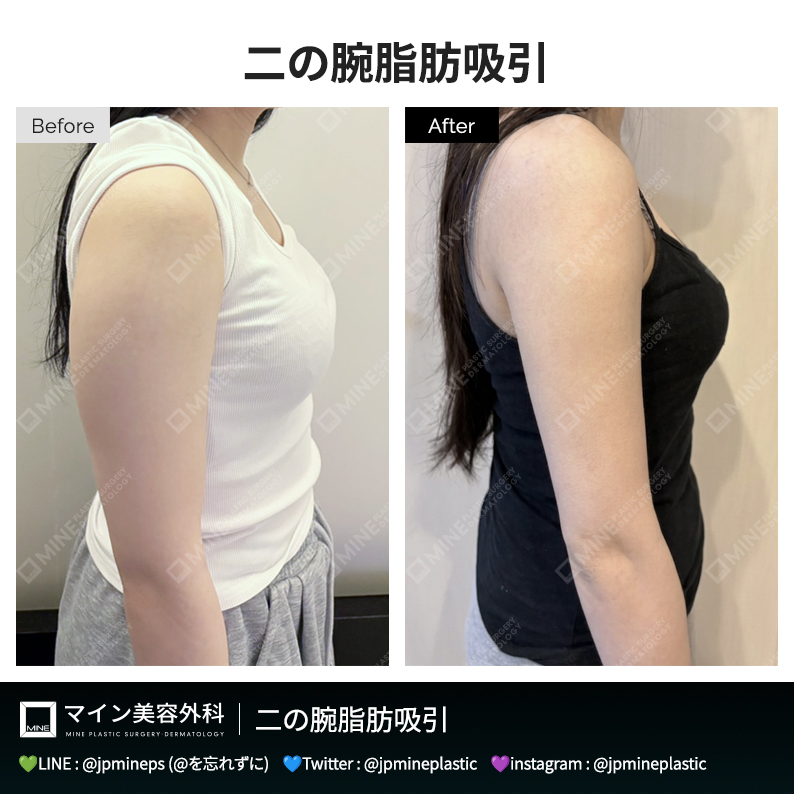 マイン美容外科・皮膚科 tweet media