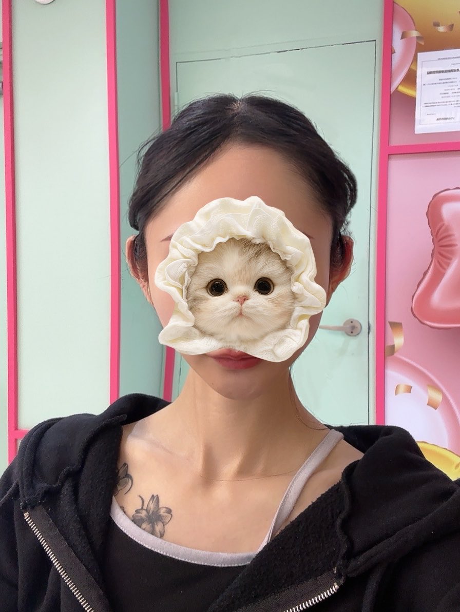 ayutetechan's tweet photo. ロリポップ美容整形外科さんで立ち耳フィラーしてきた🍭❤︎

みんなやっててかわいいなぁって思ってたし、気になる中顔面緩和できるみたいだからずっとやりたかった！ニューラミス計10cc入れた💉全然痛くなかった💭

理想の耳になってかわいー😻♩大満足🫶🏻 https://t.co/BSy4gdKW5Y