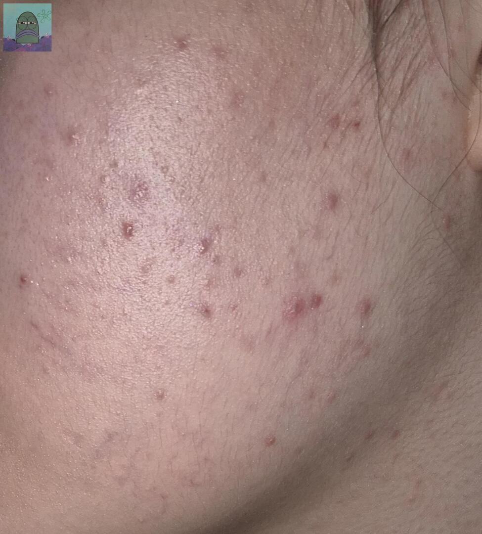 Tanyarl 💚 tweet media