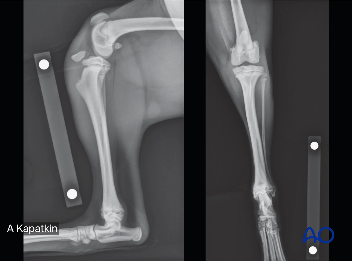 AOSurgery's tweet photo. 🐱 New AO Surgery Reference module released – Cat proximal tibia fractures 🦴

👉 AO VET members can access the module via the AO Surgery Reference platform.
https://t.co/8OmMhohEVm

#AOSurgeryReference #AOVET #VeterinaryOrthopedics #CatFractures #ProximalTibia #VetSurgery 🐾 https://t.co/5dzG9NFw5r