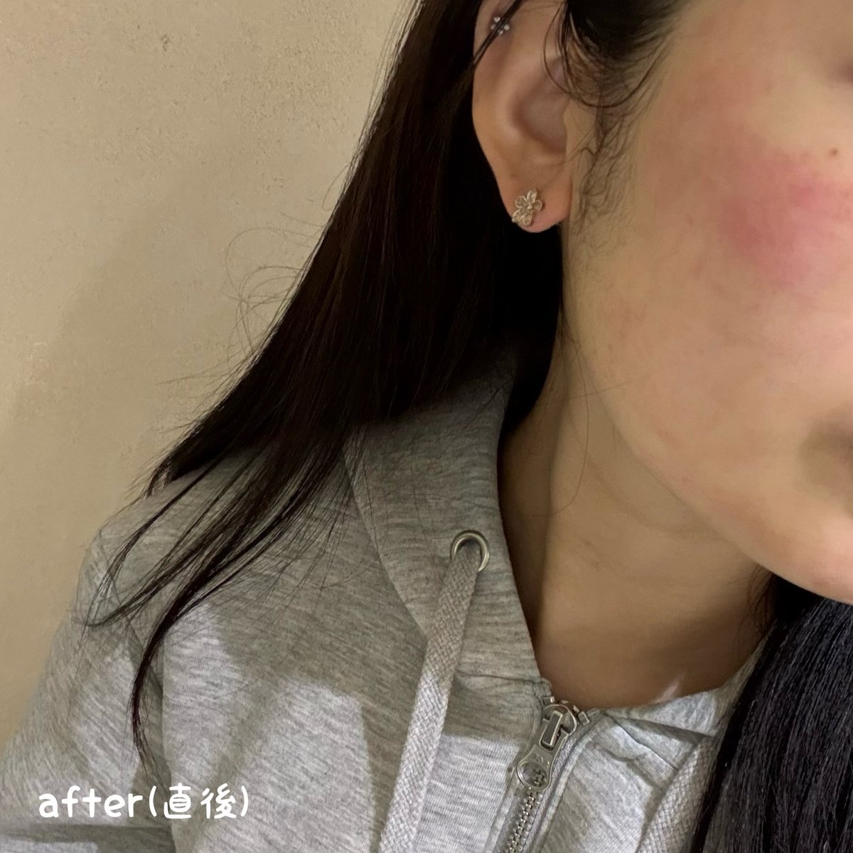 𝜗𝜚 tweet media