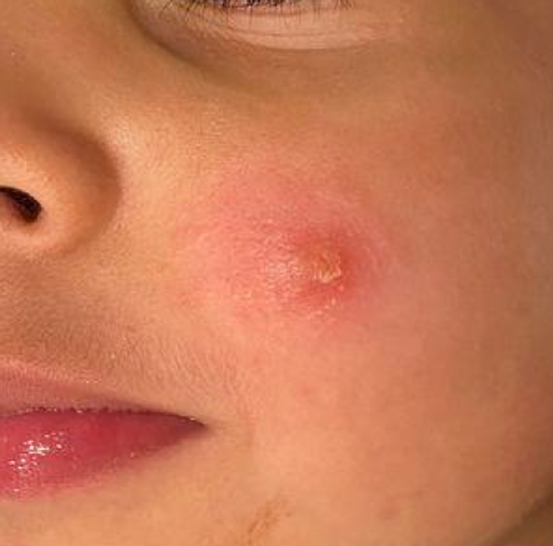 Antonio Guerrero tweet media