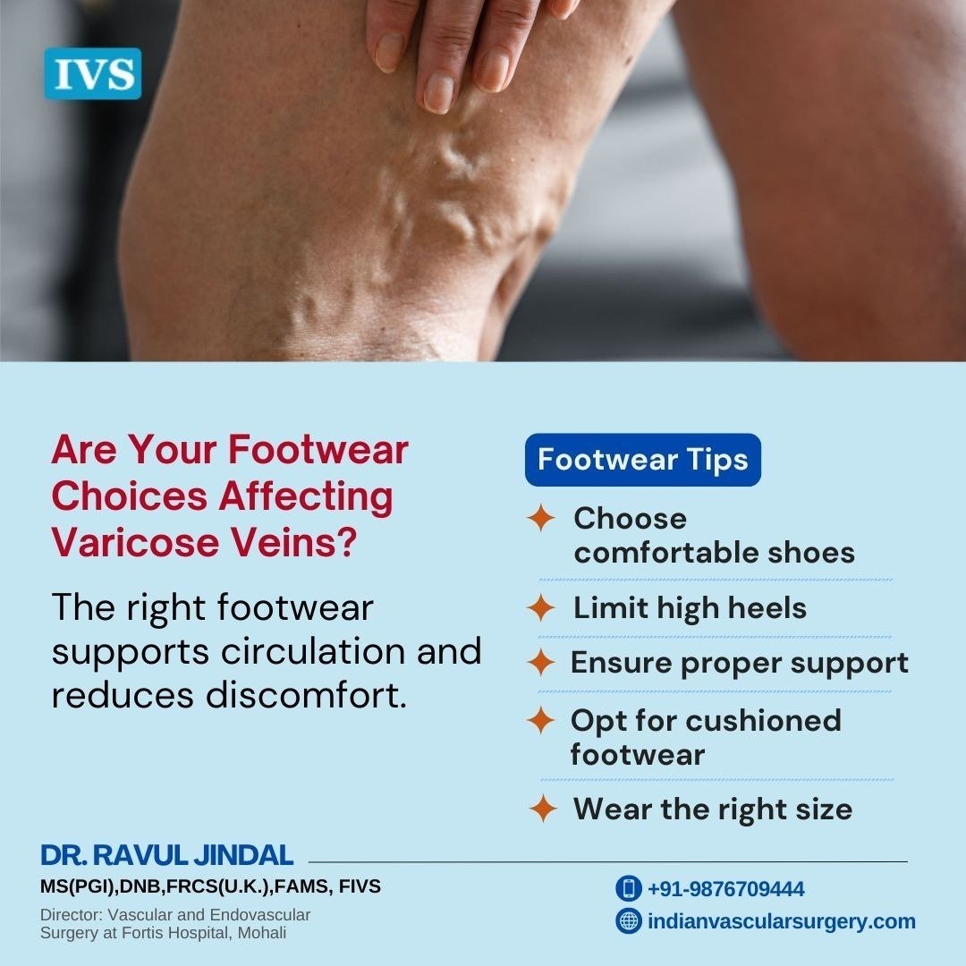DrRavulJindal's tweet image. Proper footwear can support the feet, especially for individuals with varicose veins. Choosing supportive shoes may help improve overall leg health. 
shorturl.at/IDG25
#VaricoseVeins #FootHealth #HealthyFeet #LegHealth #VeinHealth