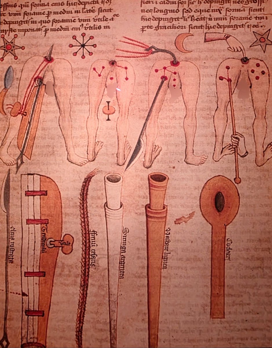 Dr_TheHistories's tweet photo. An illustration from a medieval medical manuscript depicting surgical instruments and procedures, often associated with the work of John of Arderne... 

The text and diagrams illustrate techniques for treating conditions like anal fistula, a specialty of John of Arderne. 

The top row depicts the human body to show the location of diseases and the application of tools. 

The bottom row shows various instruments used in medieval surgery, including cauteries and probes. 

Such manuscripts were crucial for educating medieval surgeons on anatomy and surgical techniques. 

#drthehistories