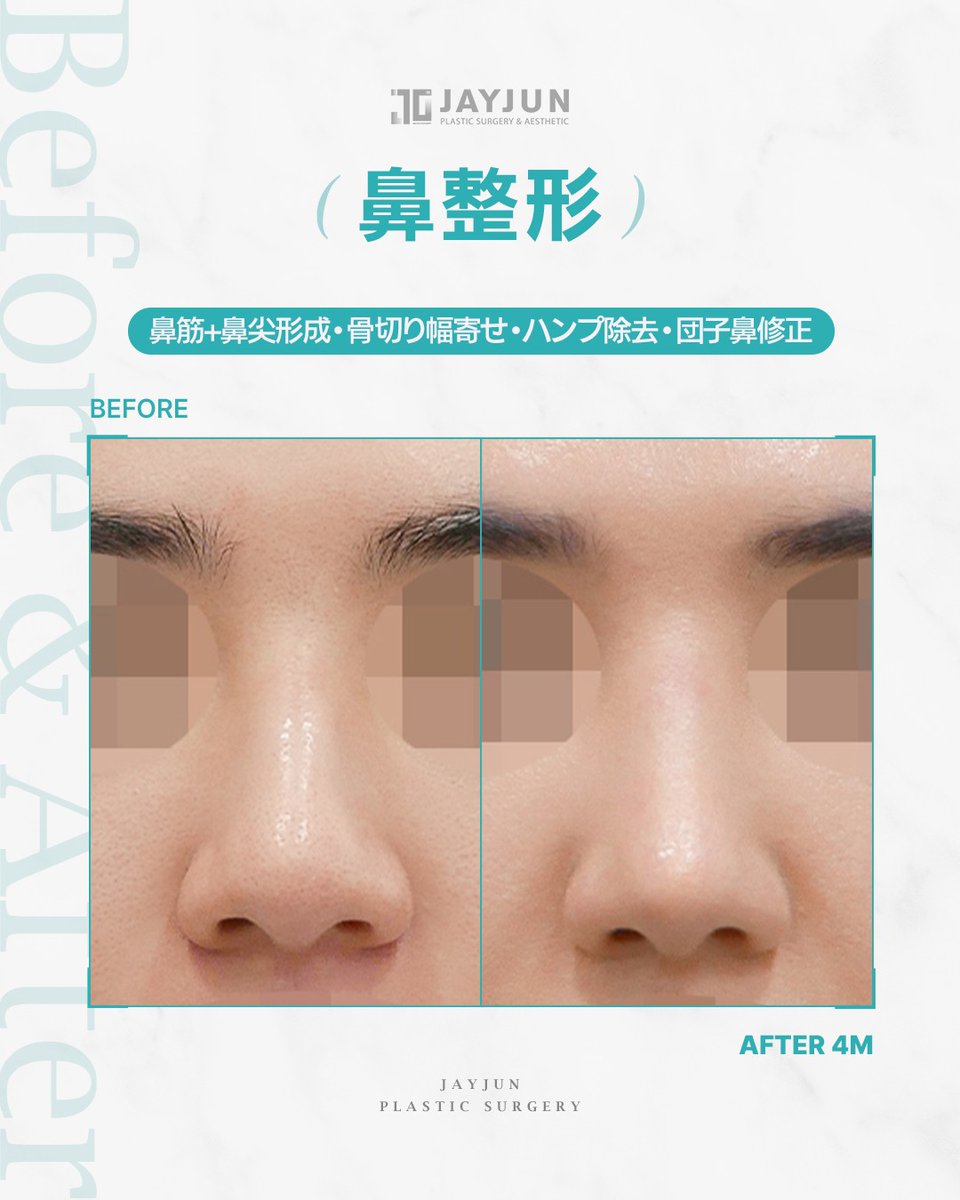 〚公式〛JAYJUN美容外科•皮膚科｜韓国美容 tweet media