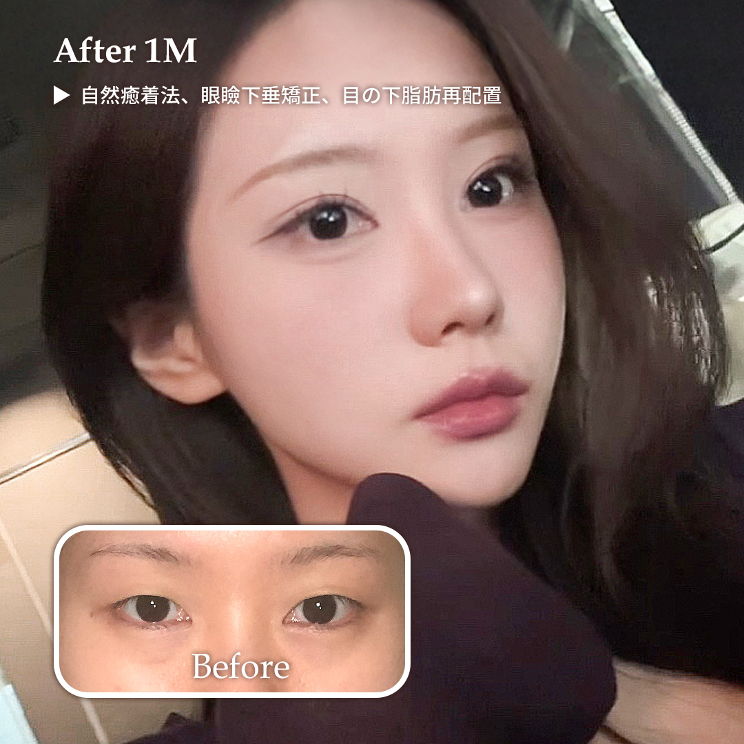 ルーヴル美容外科 tweet media