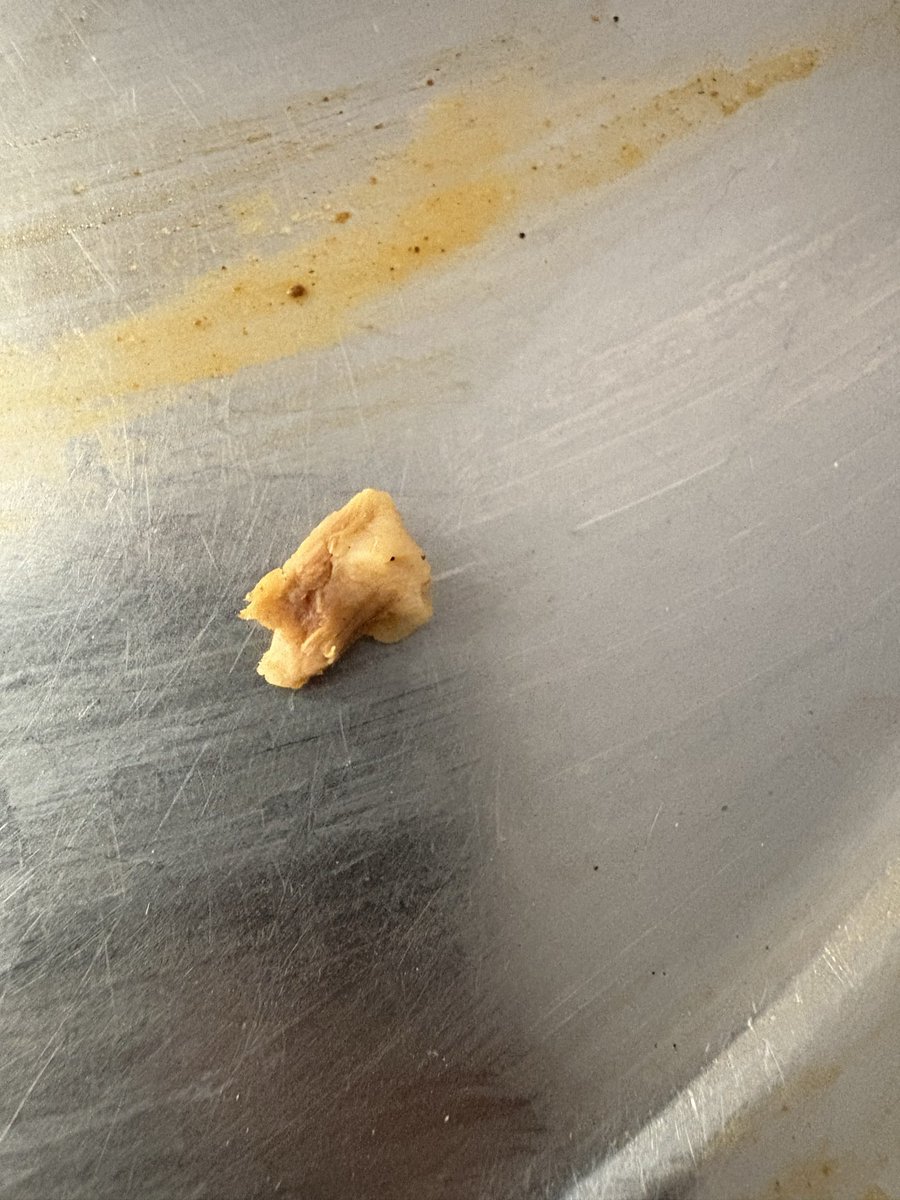 nikknite's tweet photo. Was having @SunfeastYippee just now and found a little meat little object in the noodle though it is soya bean but its smell is very bad so could you please clarify what all things you put in yippee as you package says beans no mentions of fresh beans or soya beans. https://t.co/7oDOC7Czk9