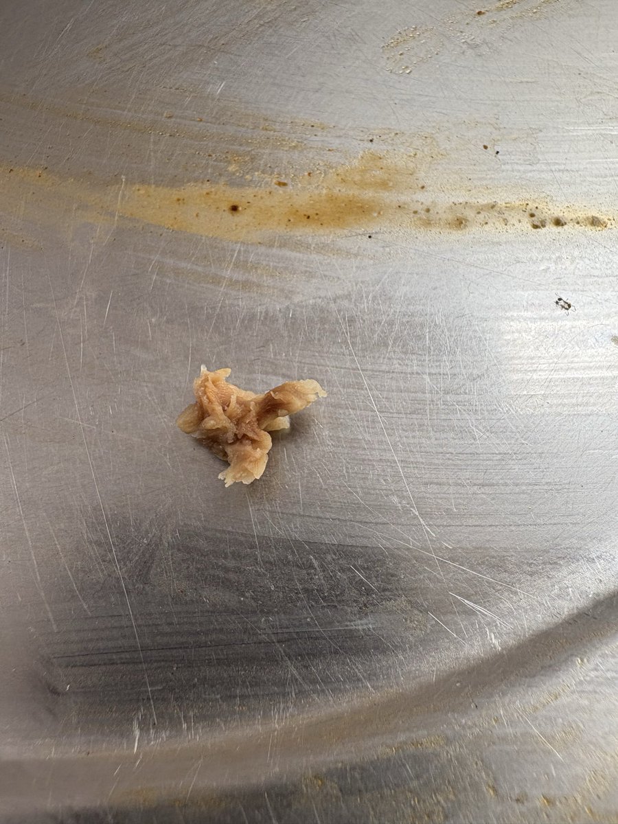 nikknite's tweet photo. Was having @SunfeastYippee just now and found a little meat little object in the noodle though it is soya bean but its smell is very bad so could you please clarify what all things you put in yippee as you package says beans no mentions of fresh beans or soya beans. https://t.co/7oDOC7Czk9