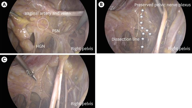 Journal of Gynecologic Oncology tweet media
