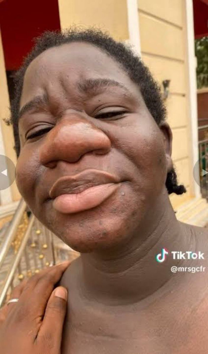 My Aphone tweet media