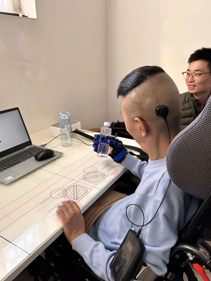 China approves world's first implantable brain-computer interface for ...