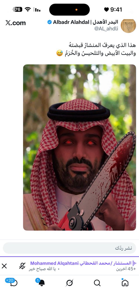 AL_ahdli's tweet image. سلمان بن حثلين قام بحظري بعد توضيح فداحة ما وقع فيه من نسب ممدوحة زين العابدين في المدعو امبس #MBS 

الحمدلله أني وجعته ونتفت جلدة وجهه ✊