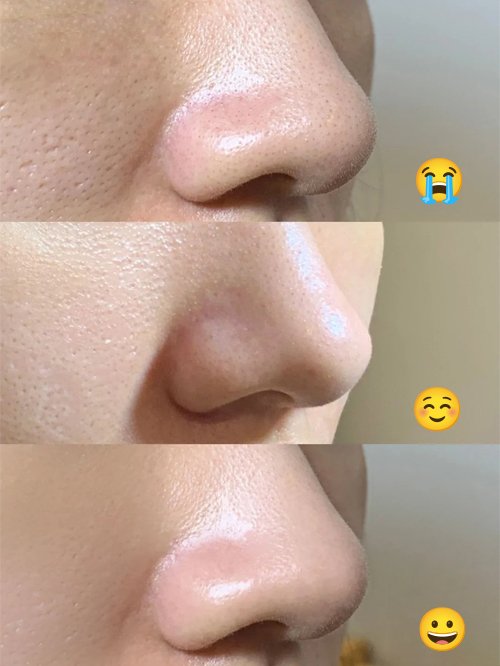 らん美容 tweet media