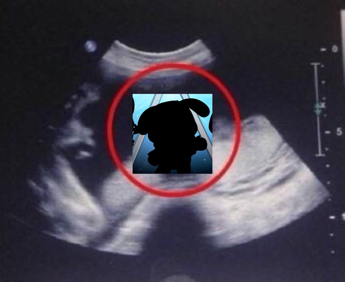 น้องป๋วย tweet media