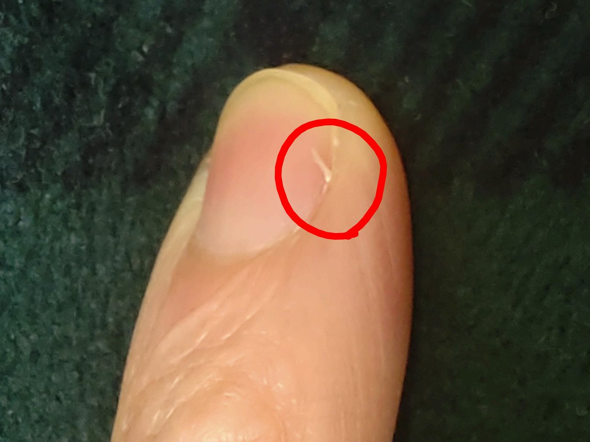 小爪(←タイケ先生にお教えいただいた)が出て来た。加齢による保湿力不足なのか…🥲