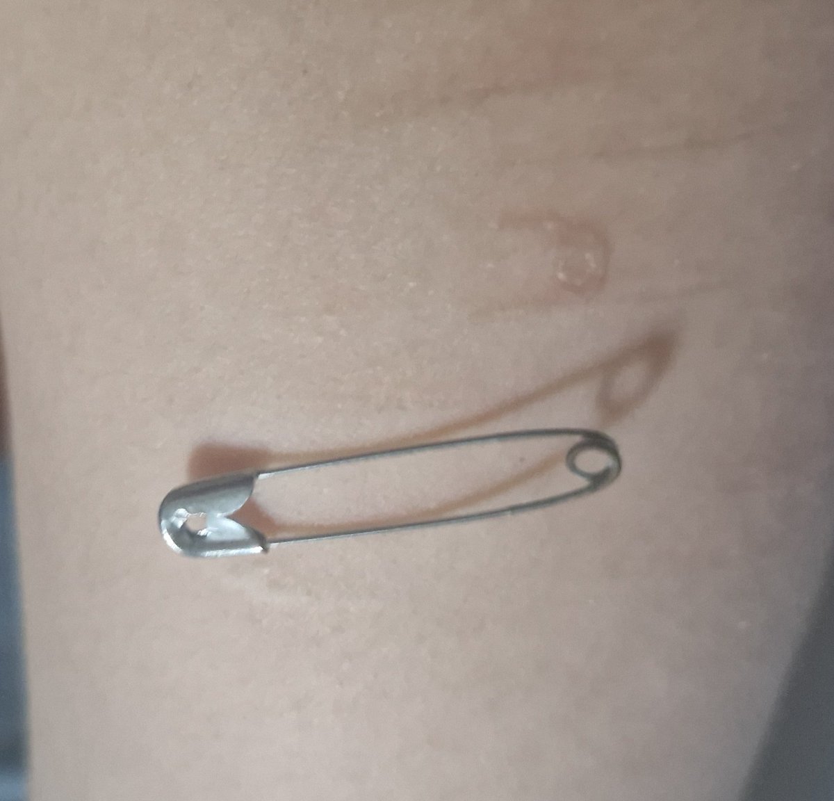 Tris🦴🦷 tweet media