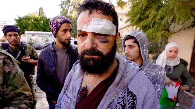 ✡︎ LULU ✡︎ 🎗 ✊ tweet media