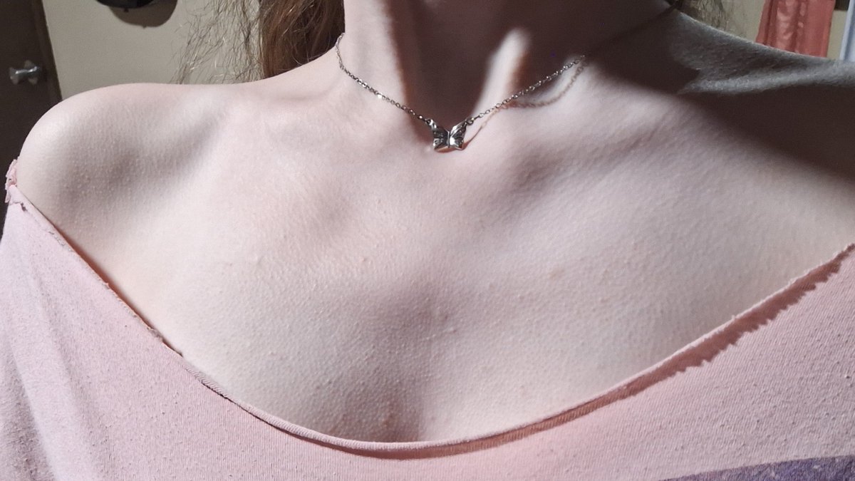 strawberry of shedtwt tweet media