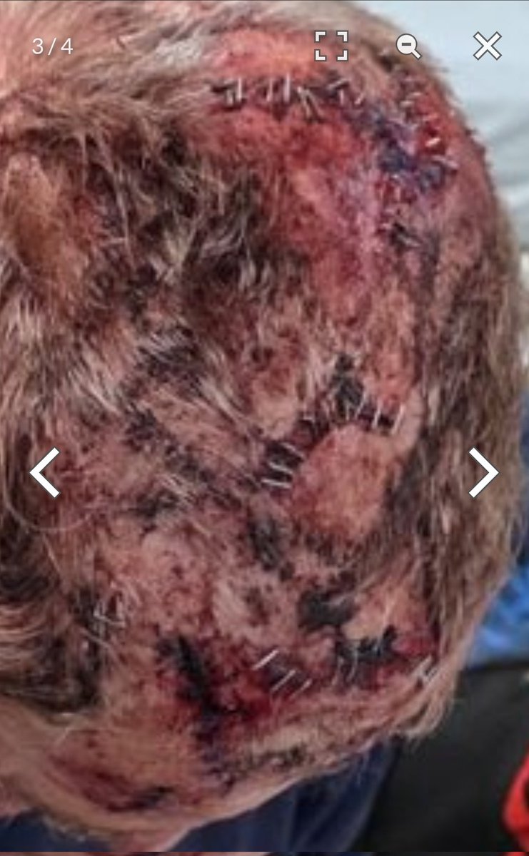 Look at this level of hatred.