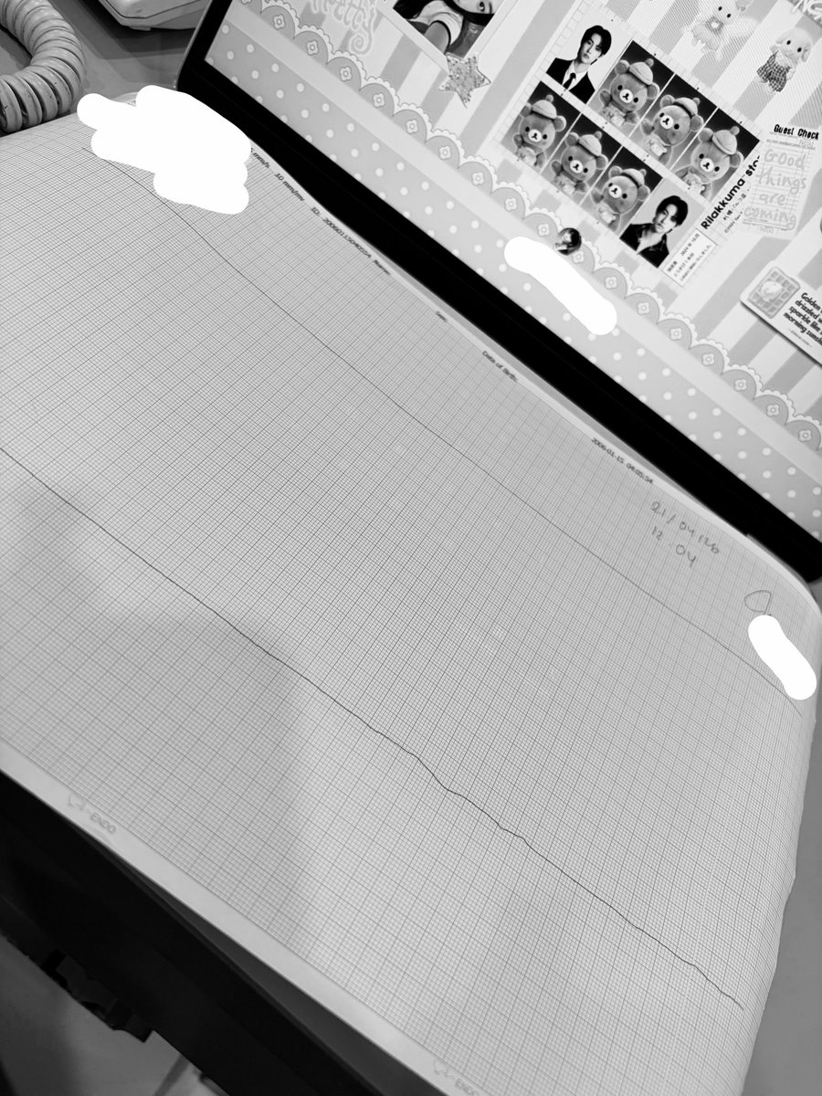 udahan ya nyanyi kicau kicau kicau manianya di igd :) innalillahi wa innailaihi rojiun.