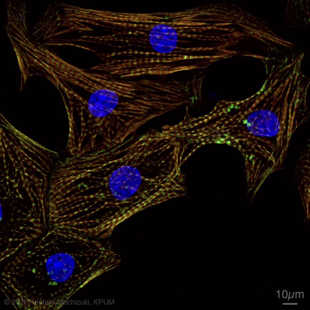 kentmochizuki's tweet image. Immuno-Fluorescence Pos.Con. (α-actinin) | Rat isolated cardiomyocyte

・Anti-α-Actinin (Sigma-Aldrich, A7811) + AF488: Green
・Rhodamine Phalloidin (Thermo Fisher, R415): Blood Orange
・TO-PRO-3: Blue

#PositiveControlSharing #Microscopy #αActinin #ポジコン共有 #顕微鏡