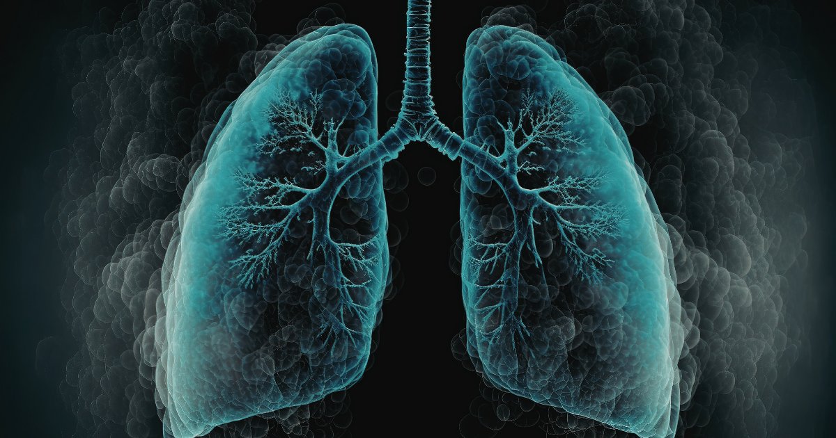 #BPCO: dati positivi dallo studio MIRANDA, il farmaco Tozorakimab riduce in modo significativo le riacutizzazioni nei pazienti. Un risultato importante nella lotta alla malattia, oggi la terza causa principale di morte a livello globale. Leggi qui: medinews.it/comunicati/toz…