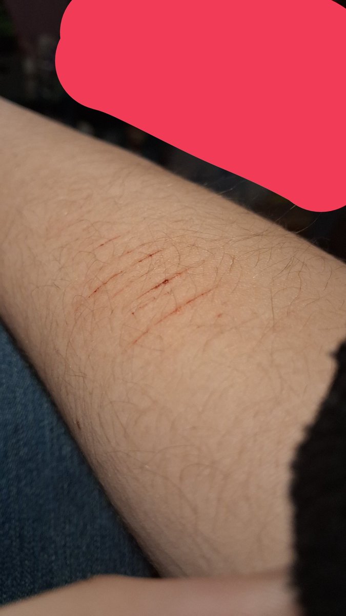 ecstasy4urheart's tweet image. cat scratches b4 school ✌️ #shtwt

my blade is really dull dont slime me out ok... glup