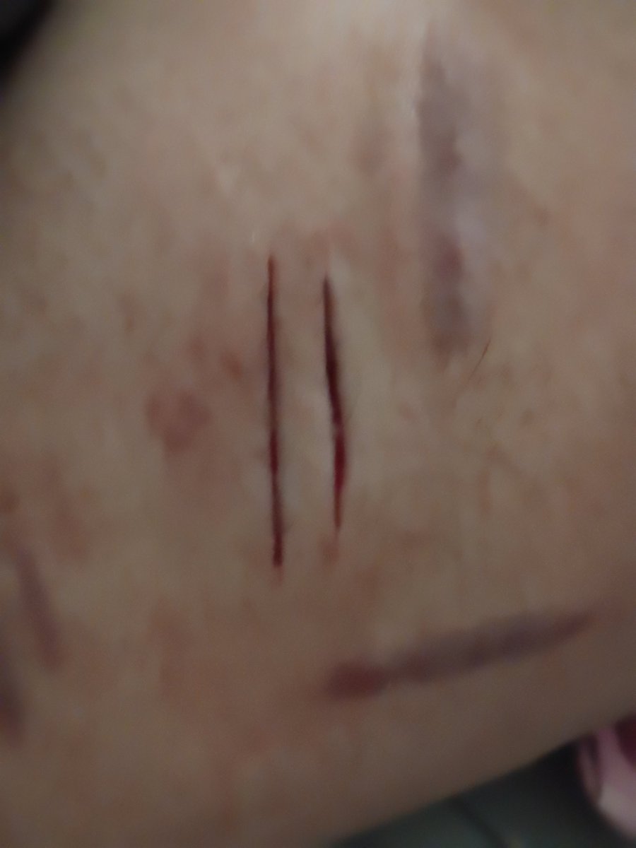 ⛧𝔐𝔦𝔪𝔦⛧ tweet media