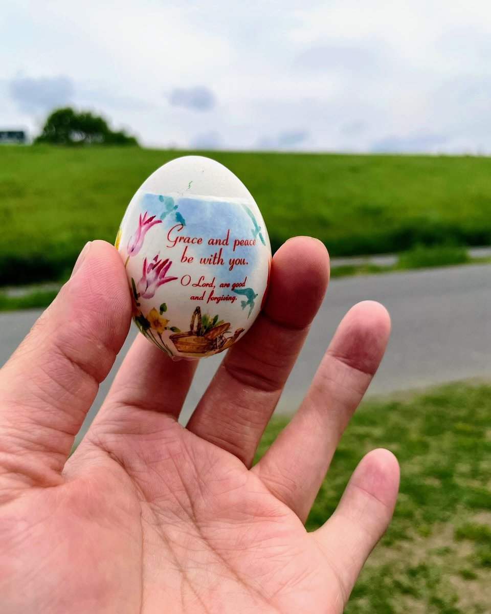 francescodeasis's tweet photo. ･`ω･) 指節癒合症あるある。「それだって君の個性なんだよ」みたいな言われ方が、見下されてるようで腹立つ。
#指節癒合症あるある
#笑うとこです https://t.co/QAZH7OsWBh