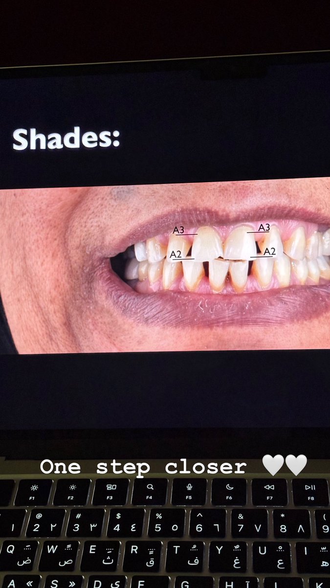Rubaalda's tweet photo. Case Presentation Level 11 

DONE 🥳🥳❤️❤️❤️❤️❤️ https://t.co/gLRXWTXEq0