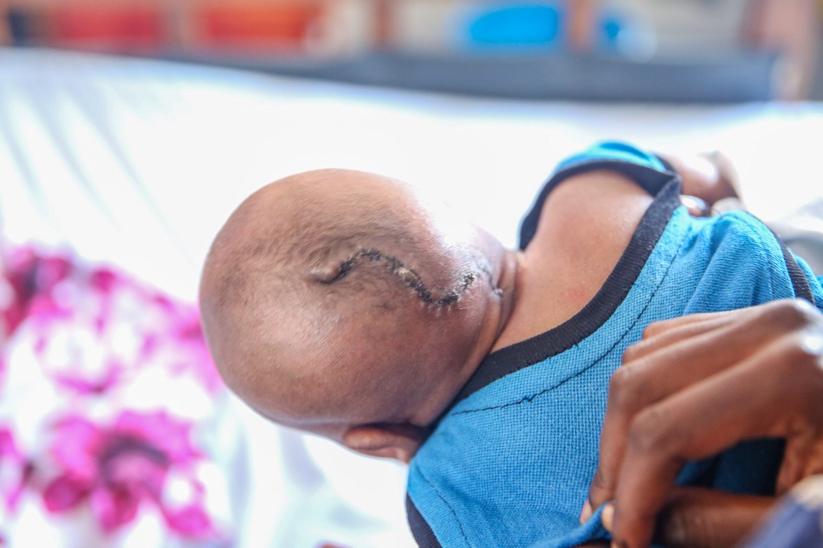 CURE Children's Hospital of Uganda tweet media