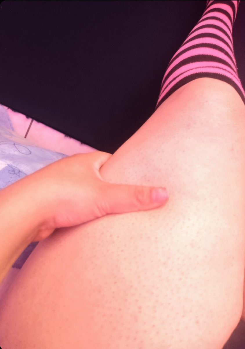 ✨Dustpink ❤️ tweet media