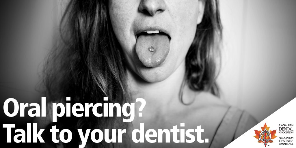 CdnDentalAssoc's tweet image. Do you have an #OralPiercing or are you considering getting one? Talk to your #dentist about potential risks of oral piercings and recommendations for #hygiene to help reduce damaging effects. Learn more: cda-adc.ca/en/about/posit…