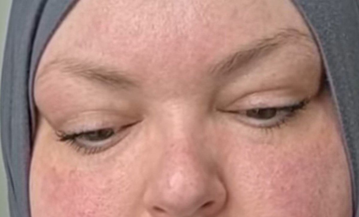 PennyJd72's tweet image. OMG what is with her skin color???!!!! Are those freckles or dirt or black heads??? Im so confused.  Ewwww #FoodieBeauty #gross