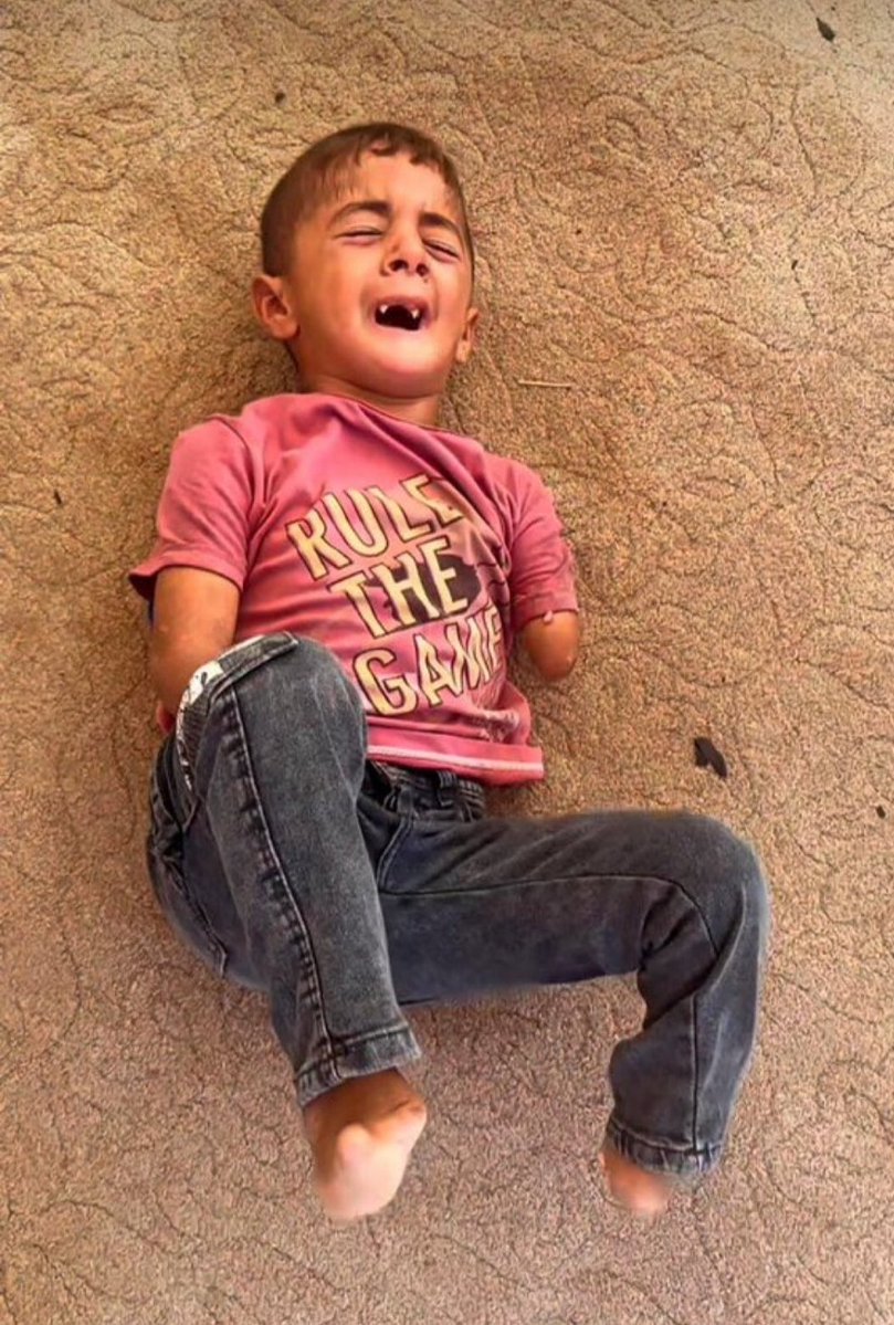 EsnFidan98655's tweet image. "Toprakları işgal edilmiş, uzuvları çalınmış ama ruhları asla teslim alınamamış çocuklar... ✨ Siz mi engellisiniz yoksa kalbi taşlaşmış bu dünya mı? 🇵🇸 Zulme alışmayacağız, susmayacağız! 📢🚫 #GazaUnderAttack #GazaGenocide"