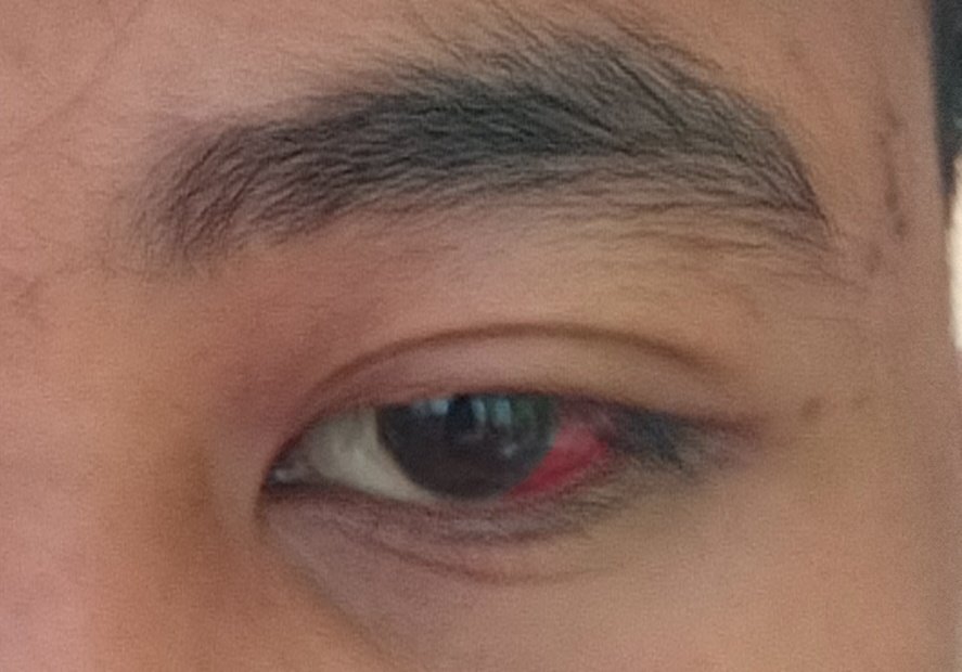 Mata saringan 👁️