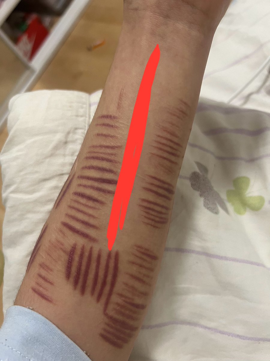 Yung Koomer Never Slit Again 🇦🇺 tweet media