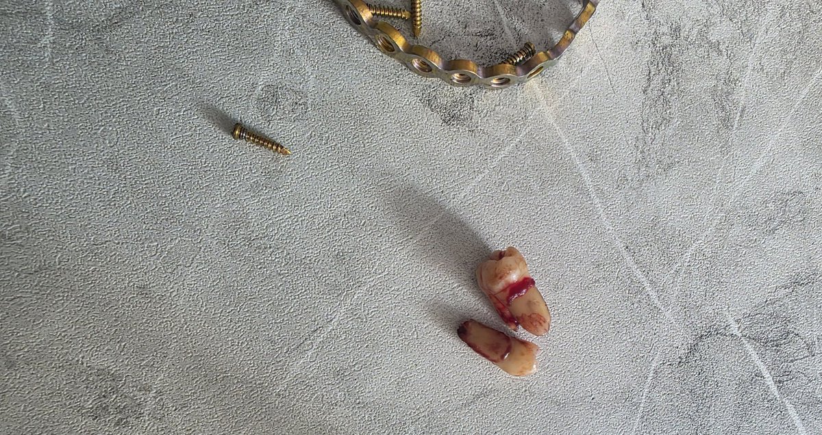 SIR TIVA tweet media