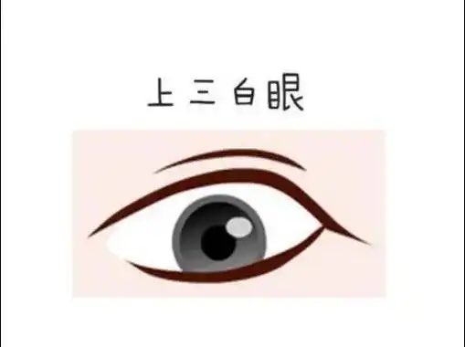 三白眼下三白(图3️⃣)是主流,上三白很少见。上三白性格傲慢争强好胜,不服输。属于阳气过剩。下三白是阴气过剩,下三白性格阴险,毒辣。上三白是明 ...