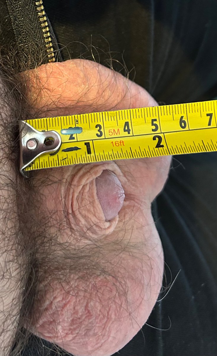 HRTDOCTOR's tweet photo. Here's the results of the HRT called : (Androcur Tablet) it makes your clitty shrink off to nothing 🧬🍤 it's very much Available in bulk

TO PLACED ORDER⤵️
𝐂𝐨𝐧𝐭𝐚𝐜𝐭 𝐔𝐬: 📥 https://t.co/uX0EIOg2wX

Worldwide Shipping 🌎🚛
Discreetly Delivery 📦❤️ https://t.co/93ZPBlHGsU